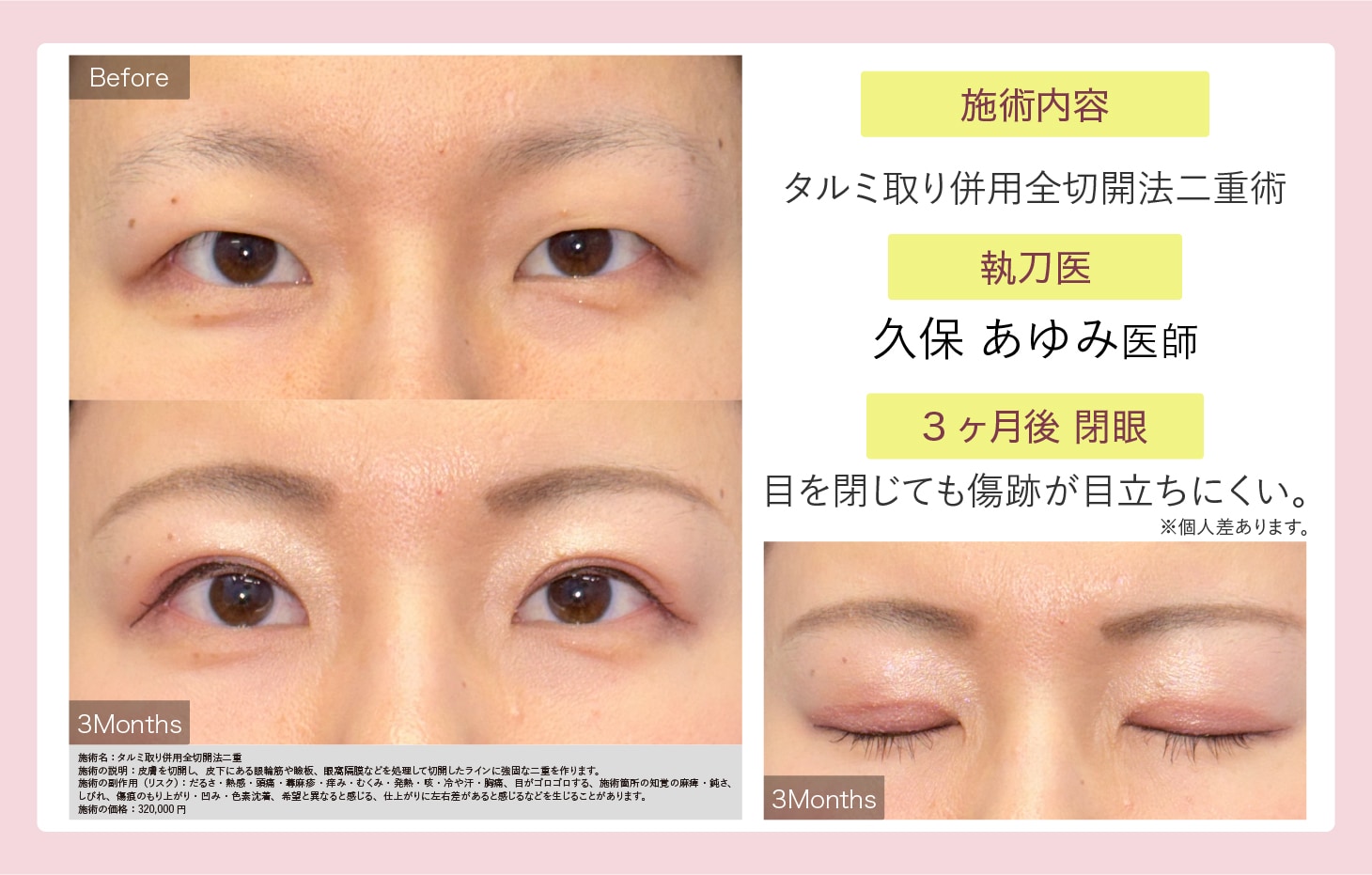 久保 あゆみ医師症例写真