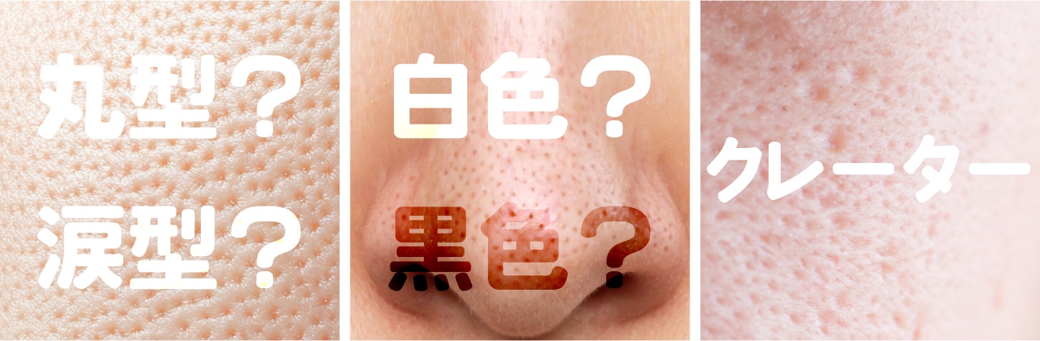 毛穴の種類は？
