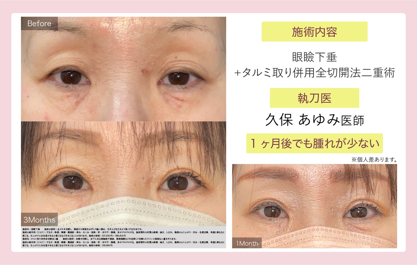 久保 あゆみ医師症例写真