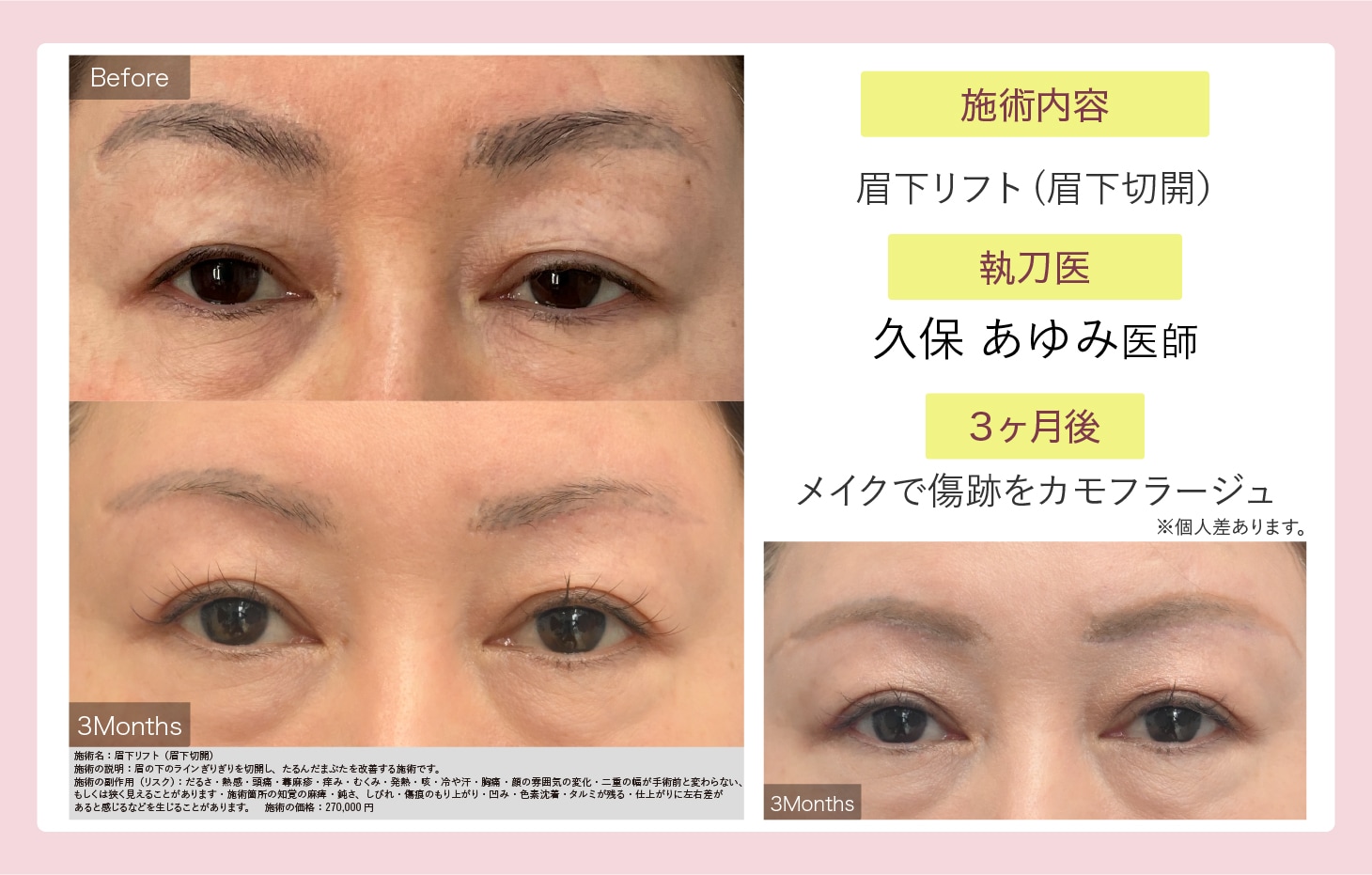 久保 あゆみ医師症例写真