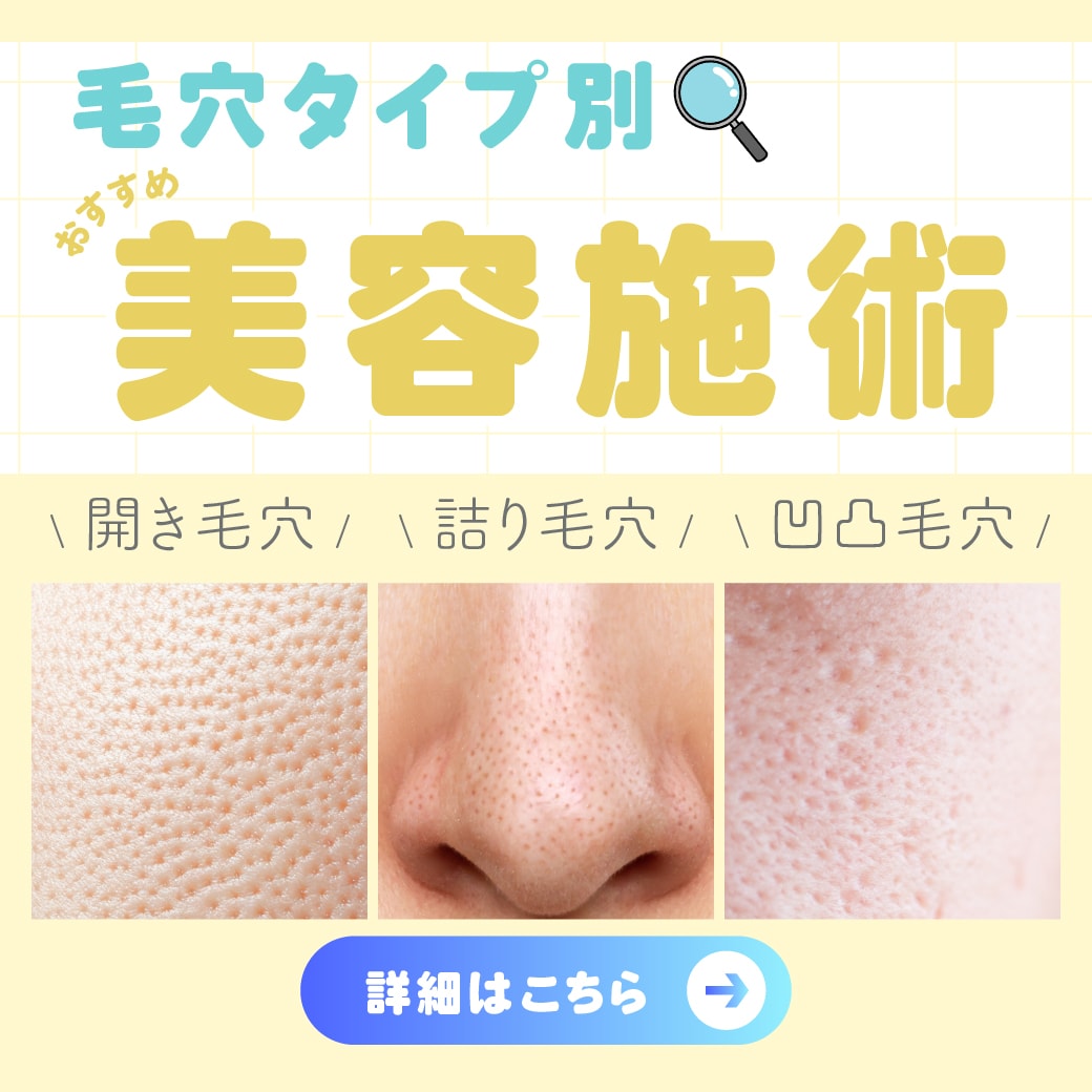 【毛穴タイプ別治療】毛穴詰り・開き・凹凸の肌悩みを湘南美容クリニック 奈良院が解決!!