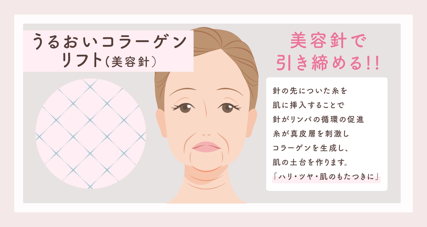 うるおいコラーゲンリフト