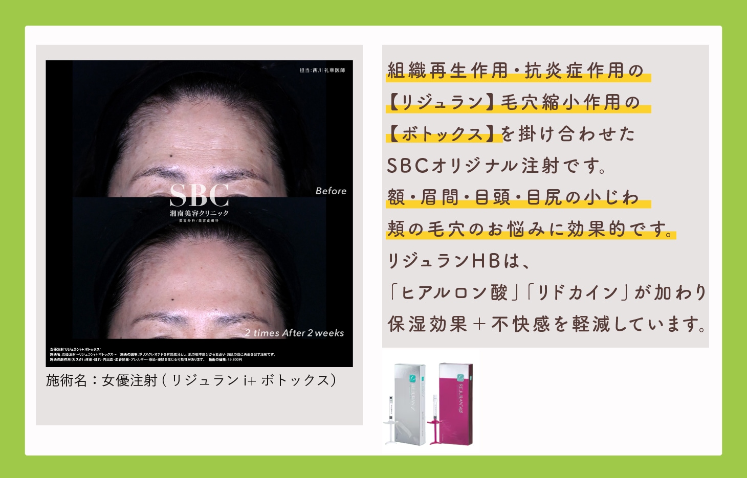 小じわ・毛穴の肌育注射_女優注射