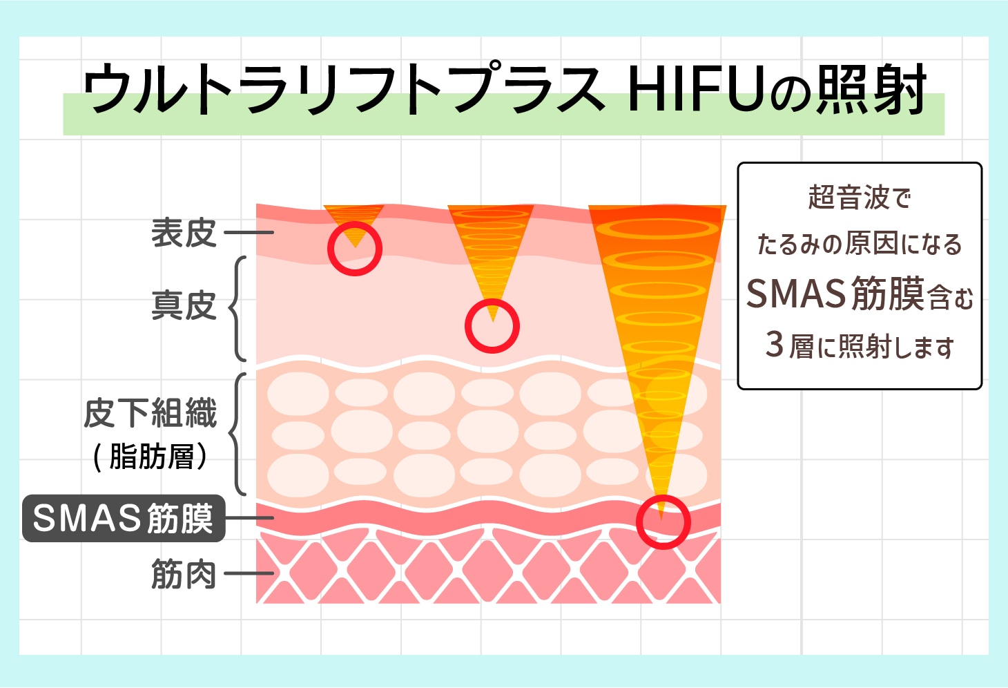 どの層にアプローチするの？