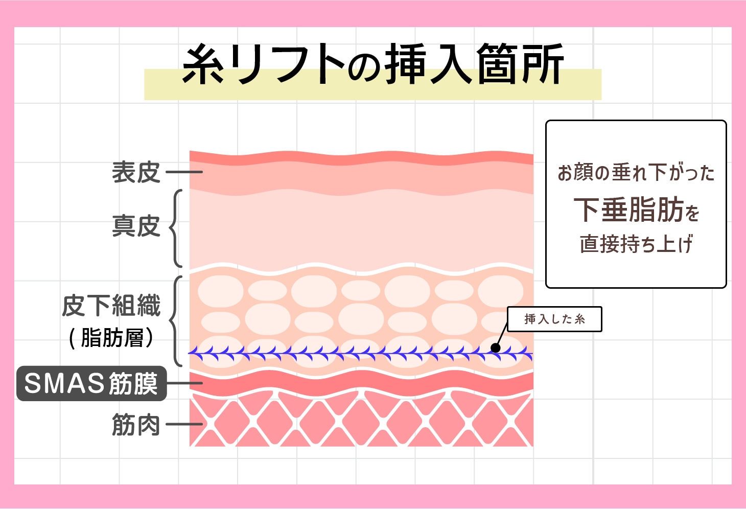 どの層にアプローチするの？