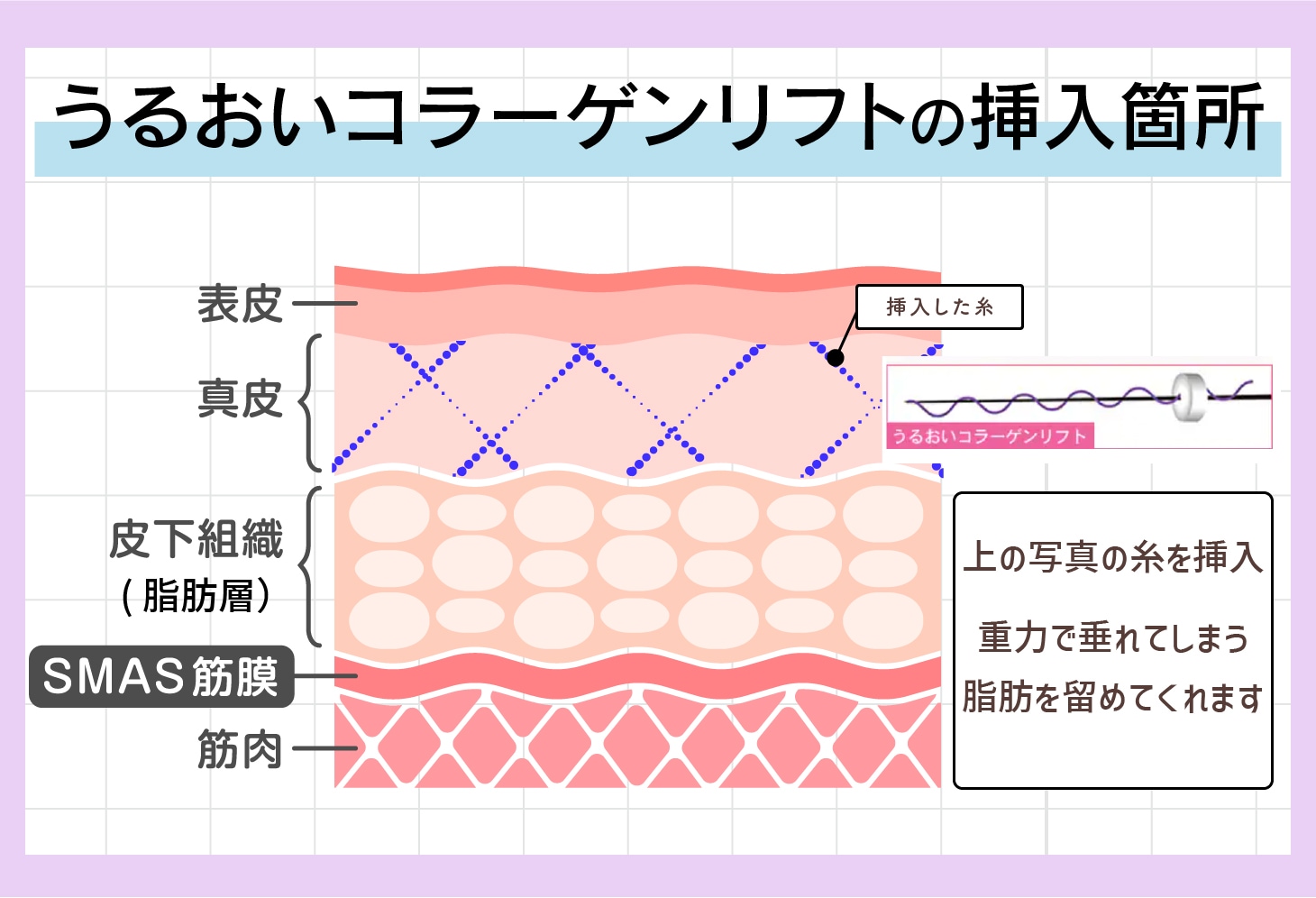 どの層にアプローチするの？