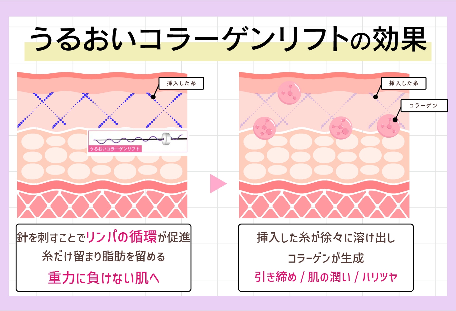 うるおいコラーゲンリフトの効果