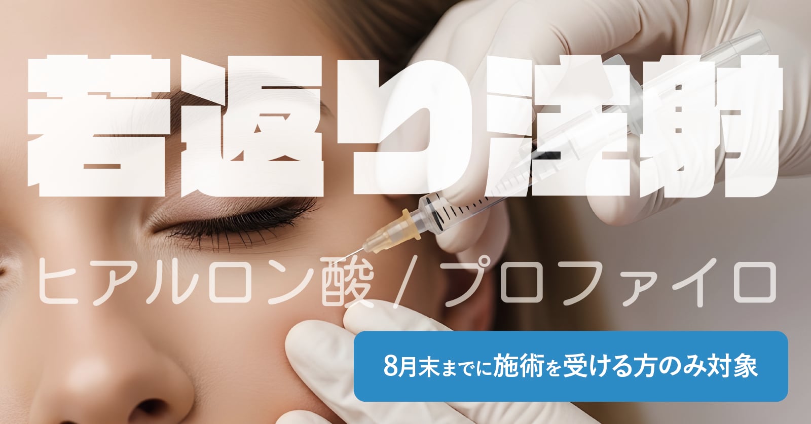 ヒアルロン酸/プロファイロ