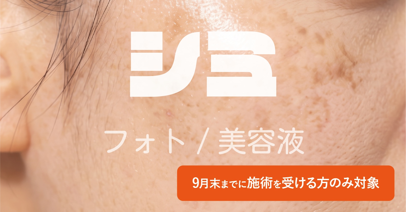 しみ