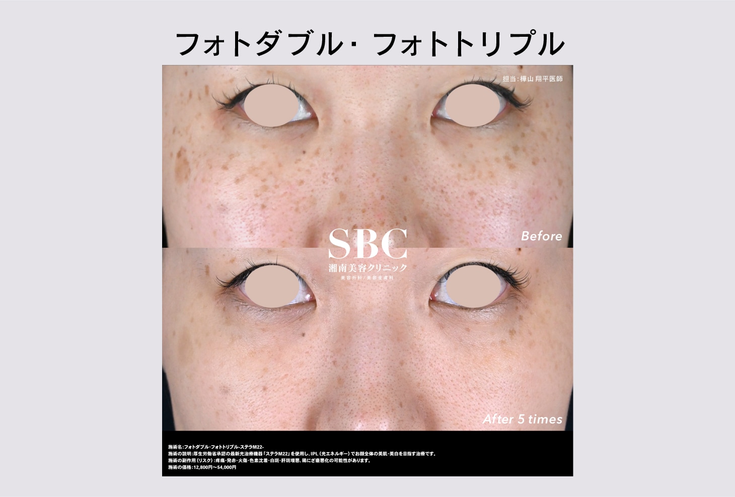 症例写真