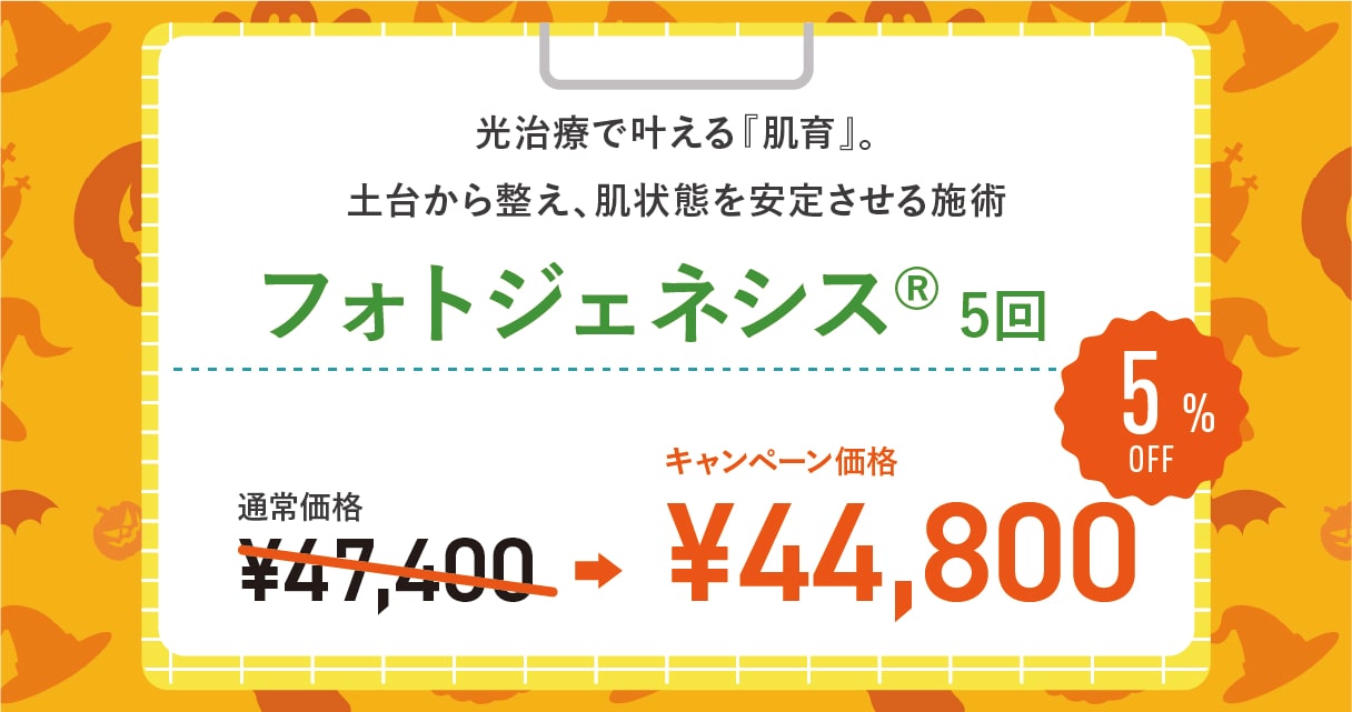 フォトジェネシス