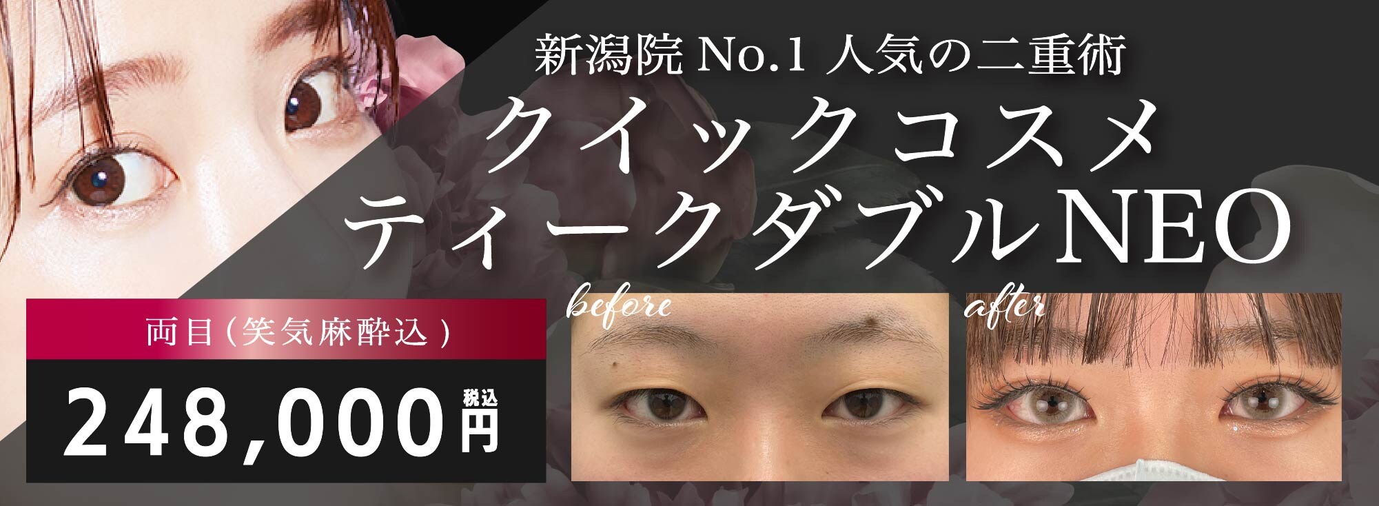 当院1番人気の二重メニュー クイックコスメティーク・ダブル