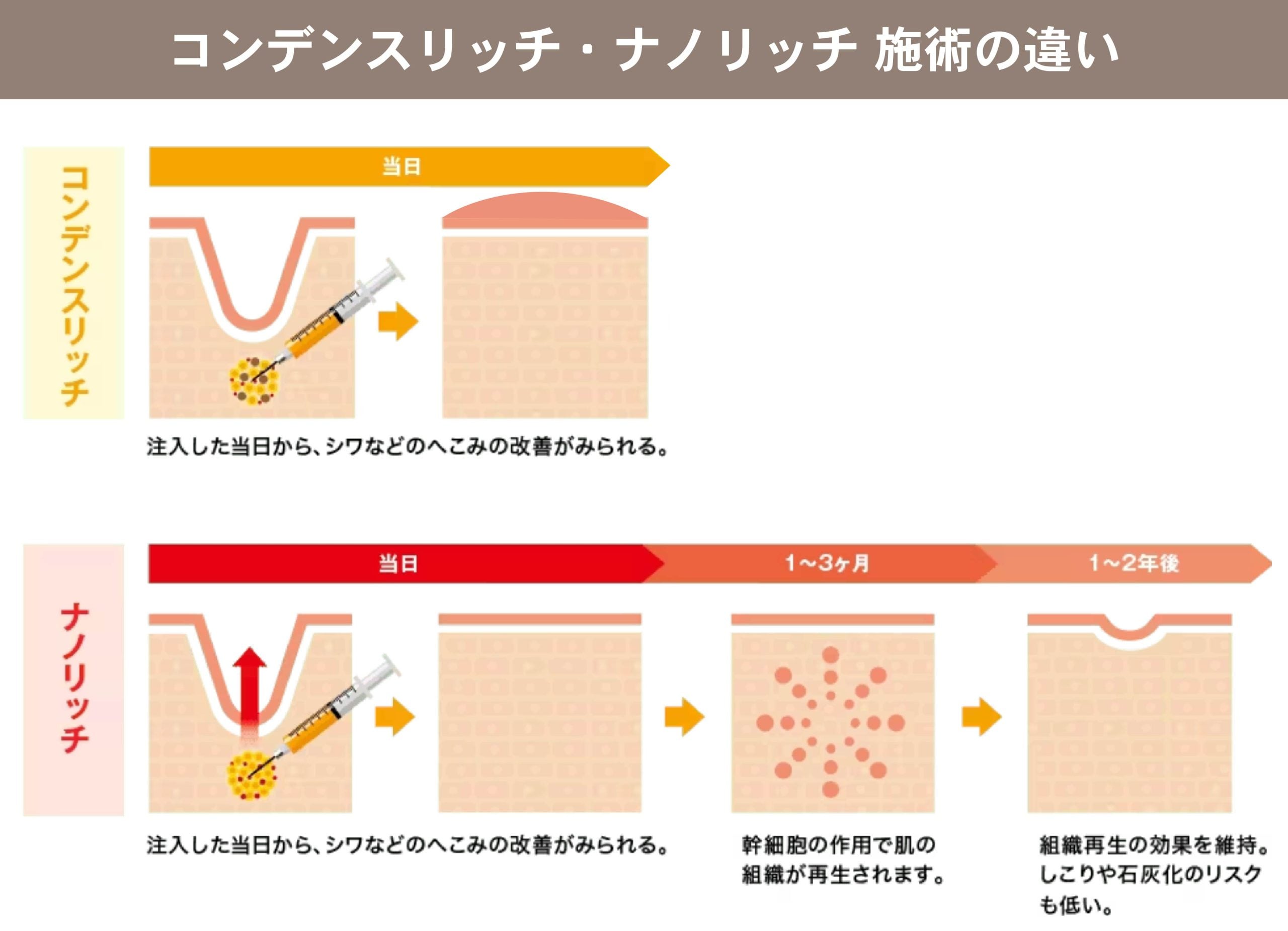 どちらも若返りに不可欠な脂肪！それぞれの特徴