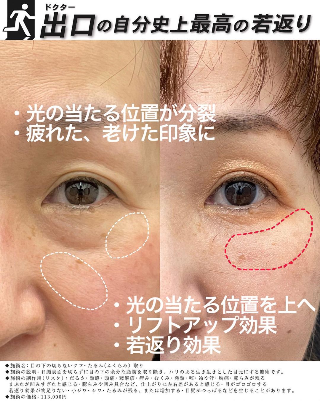 新潟で若返るなら高度な技術を持つ出口洸平医師にお任せ！【全顔脂肪 