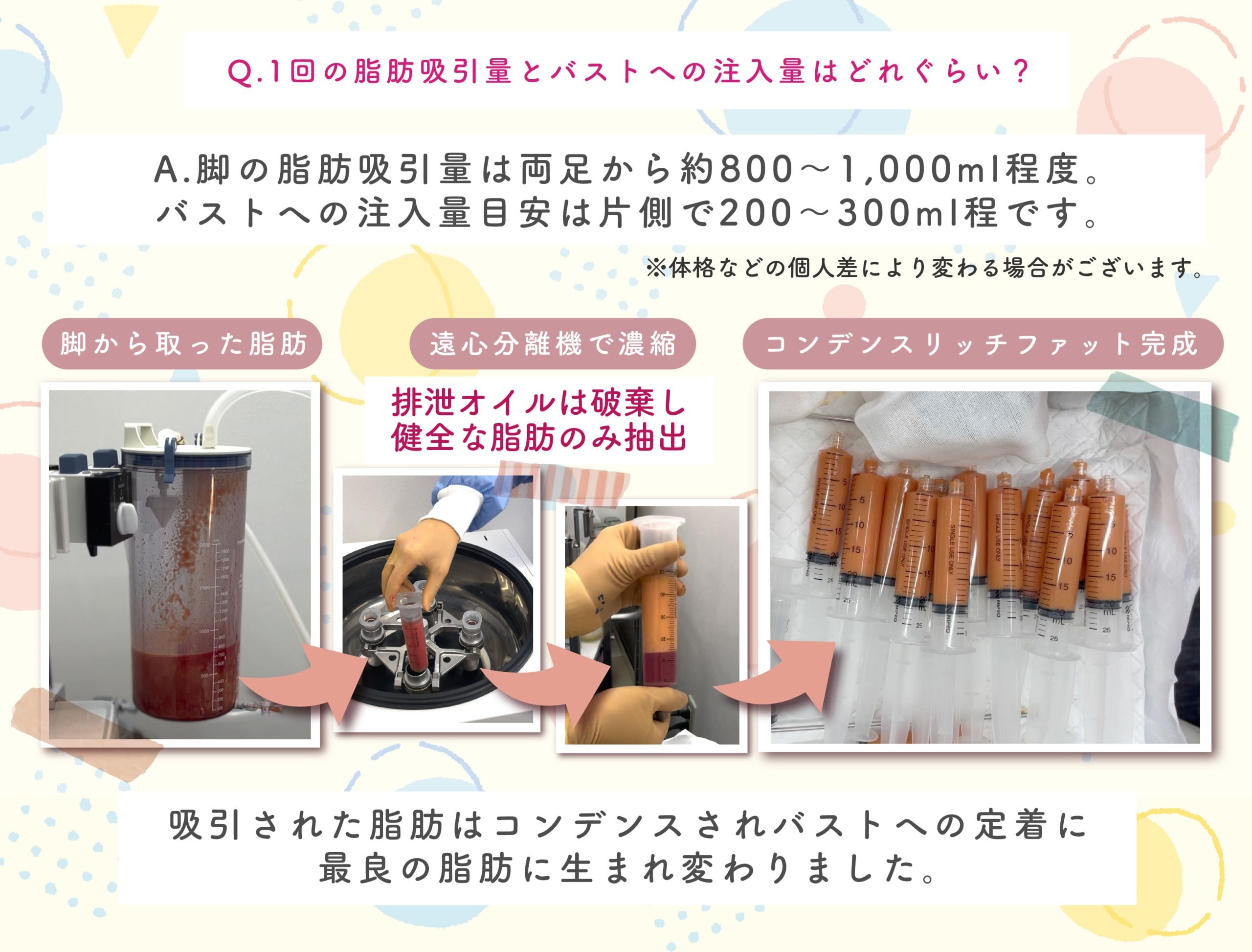 Q.1回の脂肪吸引量とバストへの注入量はどれぐらい？