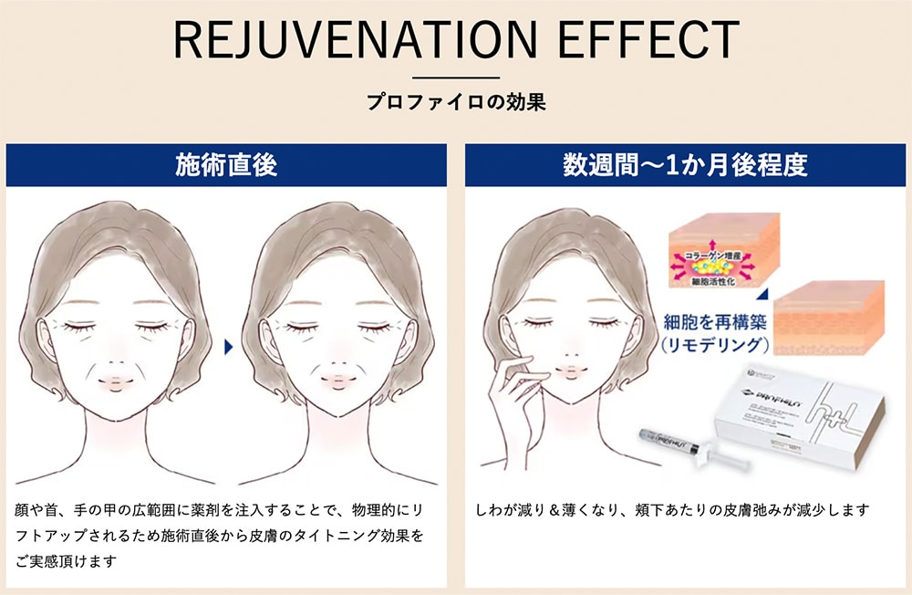 数週間～1か月後程で馴染んで変わっていく！<br />
<br />
