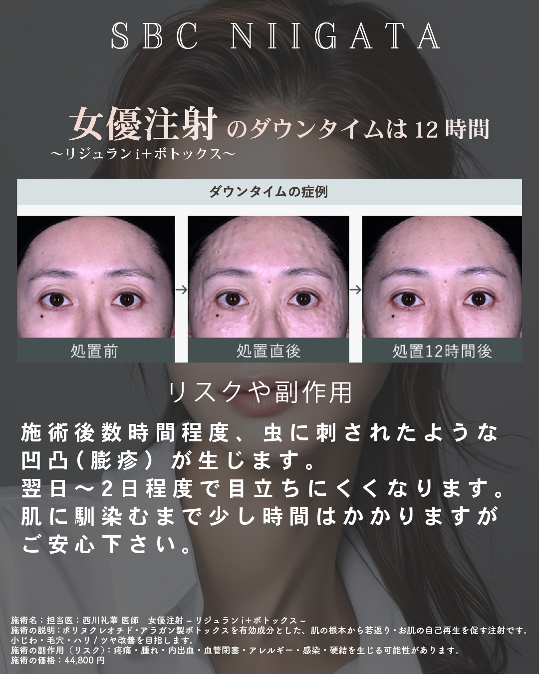女優 毛穴 圧倒的透明感！女優注射で、しわも毛穴も除去！つやつや陶器肌を目指す人必見！肌質改善しませんか？ - 新潟院