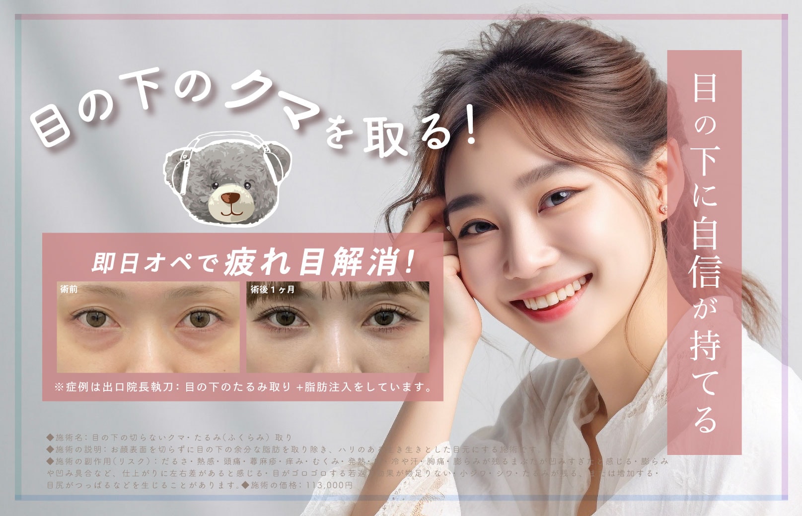 新潟で目の下のクマを即解消！30分で若返り✨理想の目元を手に入れよう！