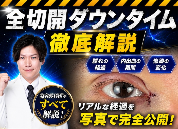 【ダウンタイム】二重全切開のダウンタイムを徹底解説!新潟で二重整形なら湘南美容クリニック新潟院へ♪