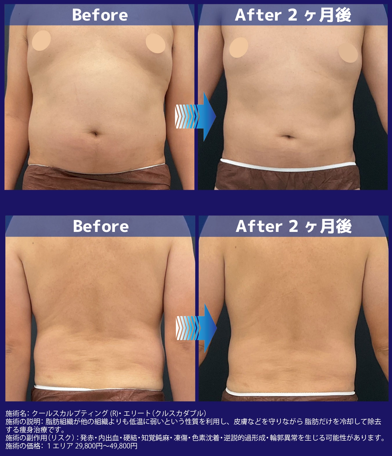 ウェストが引き締まってかっこいい！