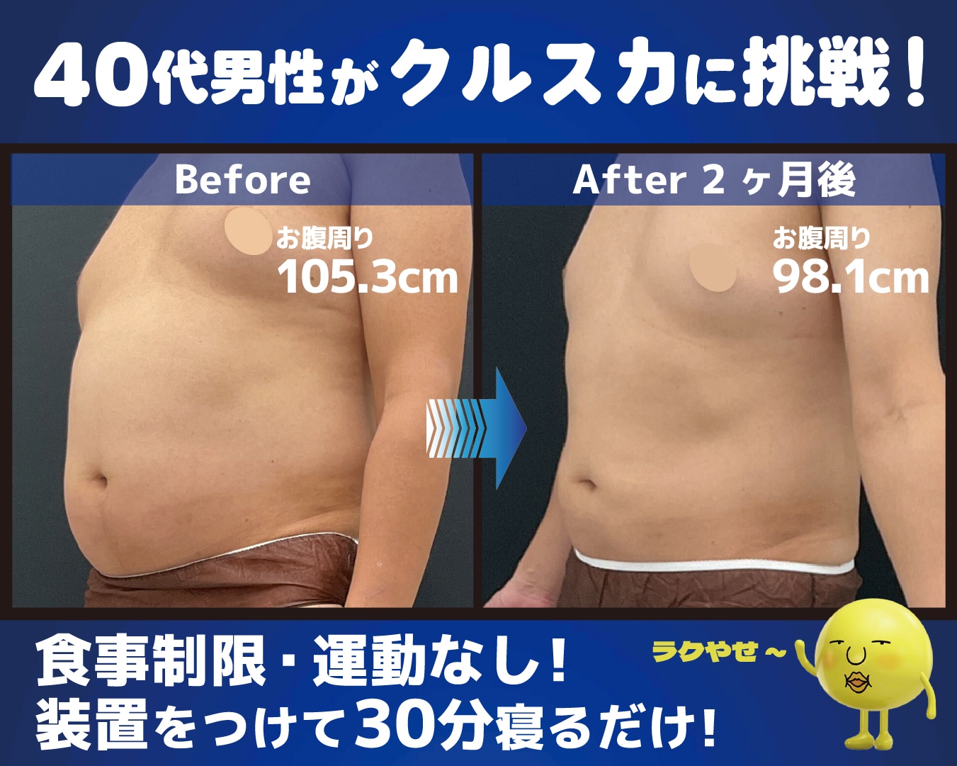 クルスカは、気になる部分の脂肪細胞を冷却して自然に減少させる全く新しい痩身法です。<br />
