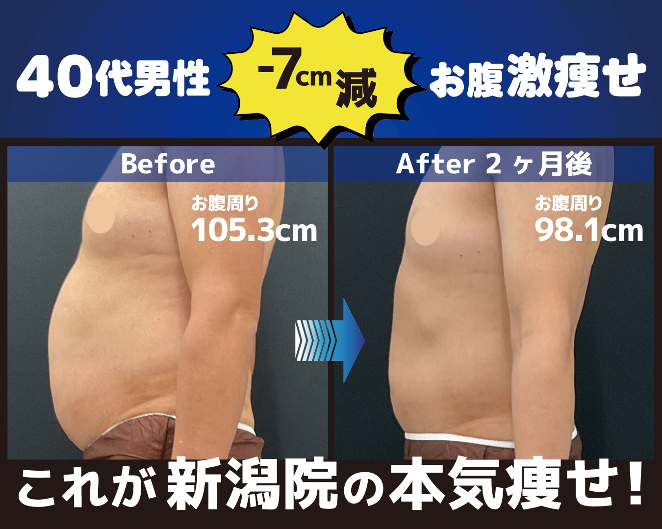 新潟で楽痩せ！【驚愕の効果！】40代男性の頑固なウエスト脂肪が-7cm！クルスカで寝ている間に楽々サイズダウン！