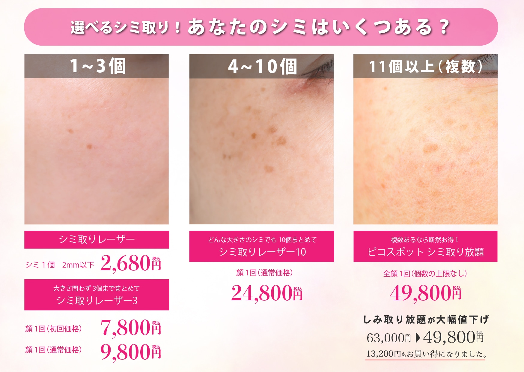 選べるシミ取りプランで美肌を目指す！