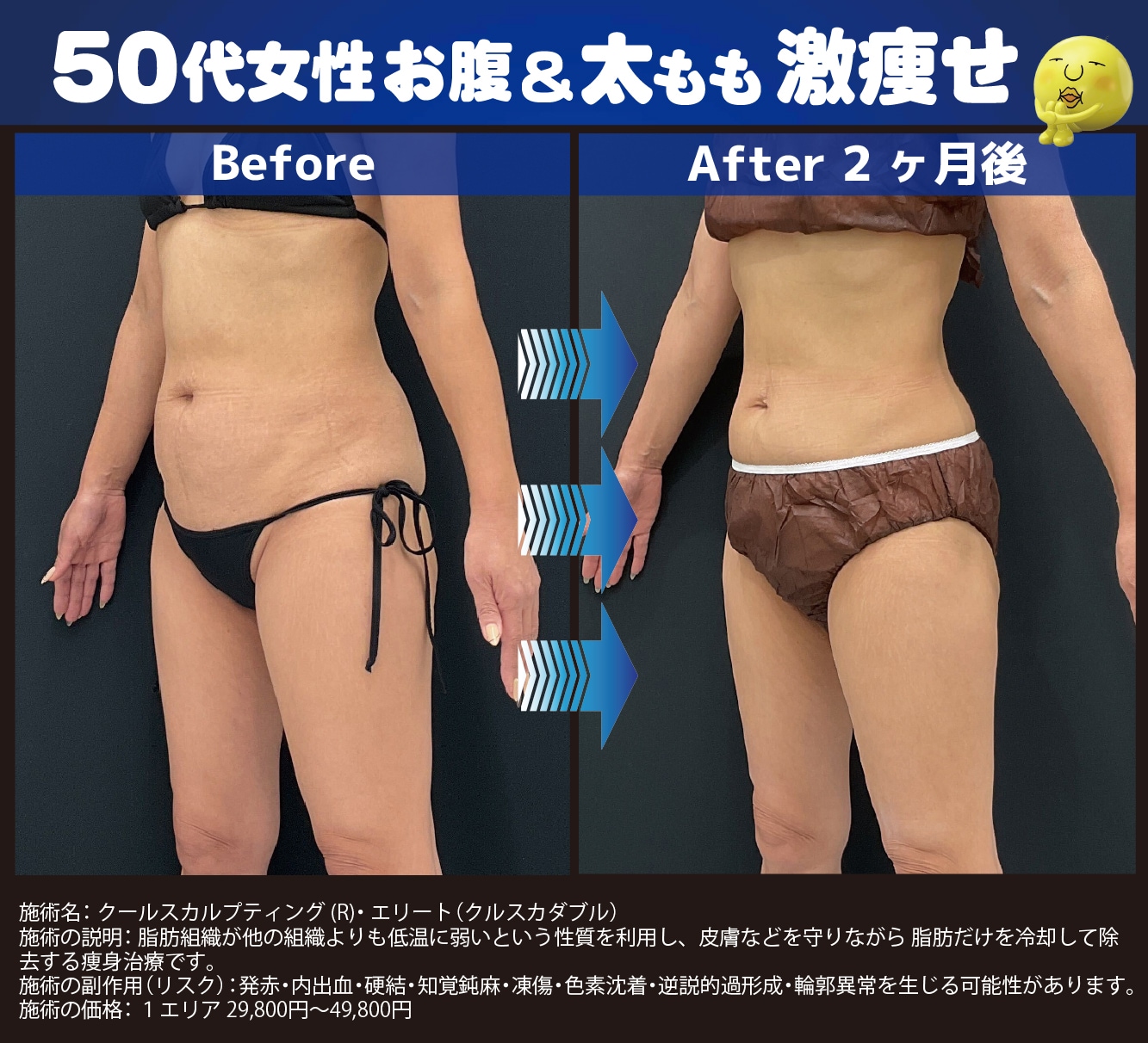 クルスカで憧れのくびれが実現！