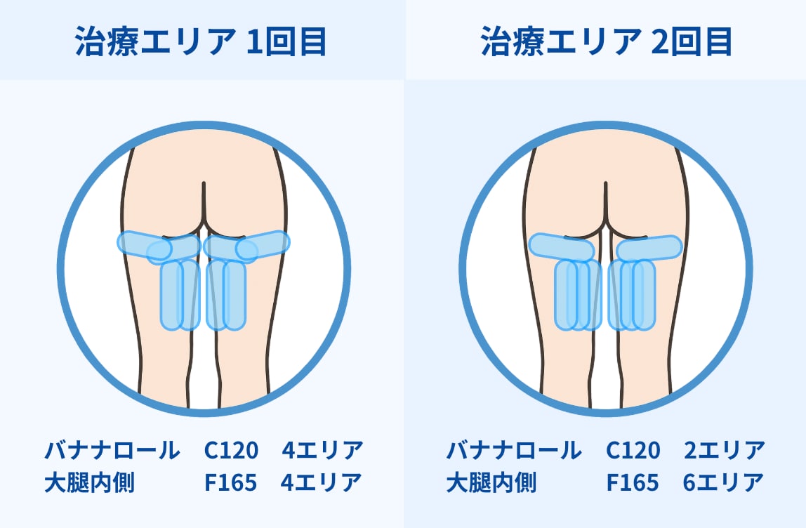 スタッフが体験した部位は？