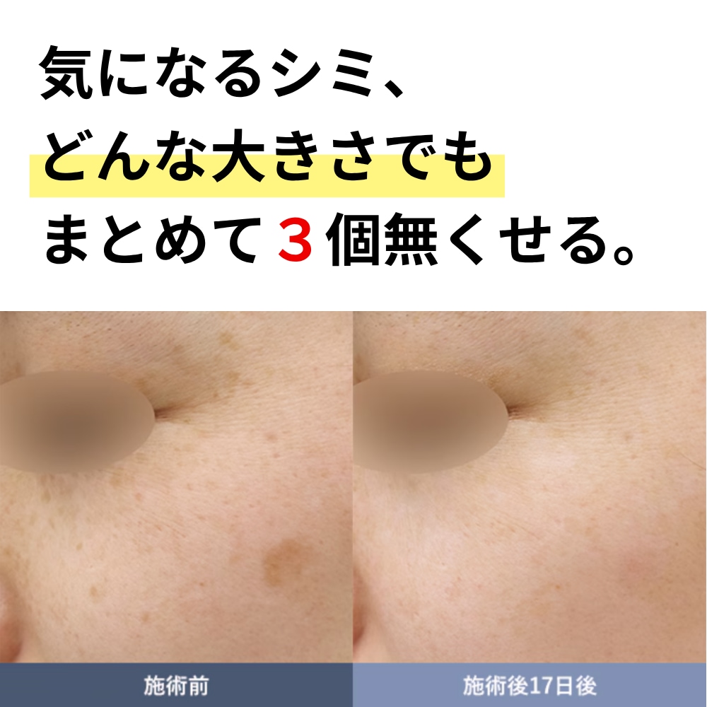初回価格　7,800円