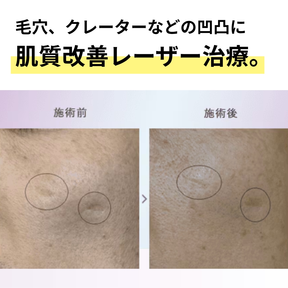 初回価格　7,800円