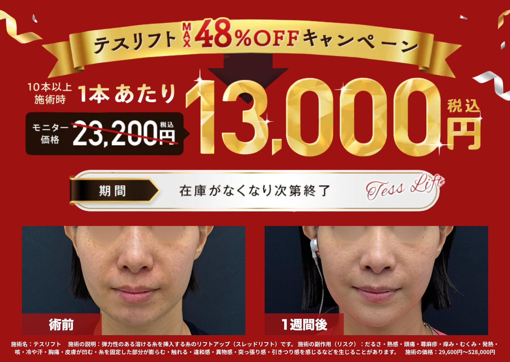 ⚡数量限定⚡<br />
