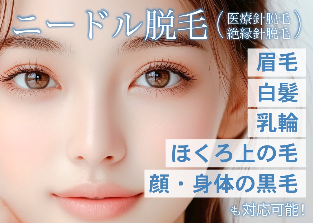 💖✨ 【中部で唯一】SBC新潟院でニードル脱毛ができる🥰 眉毛・白髪もぜーんぶまとめてツルツルに！✨