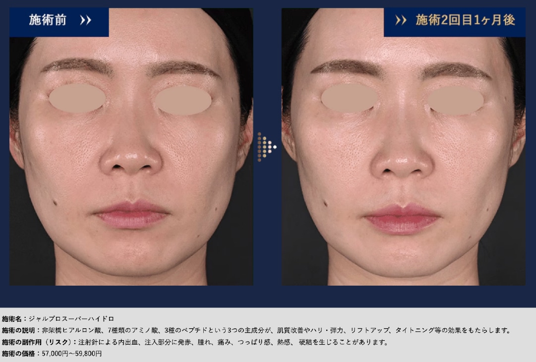 たるみの根本に、アミノ酸の「再生力」を。