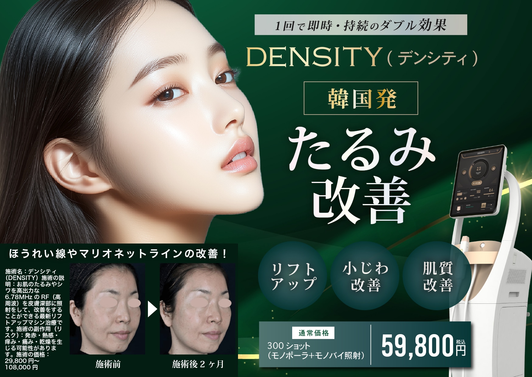 たるみ改善マシン「DENSITY（デンシティ）」