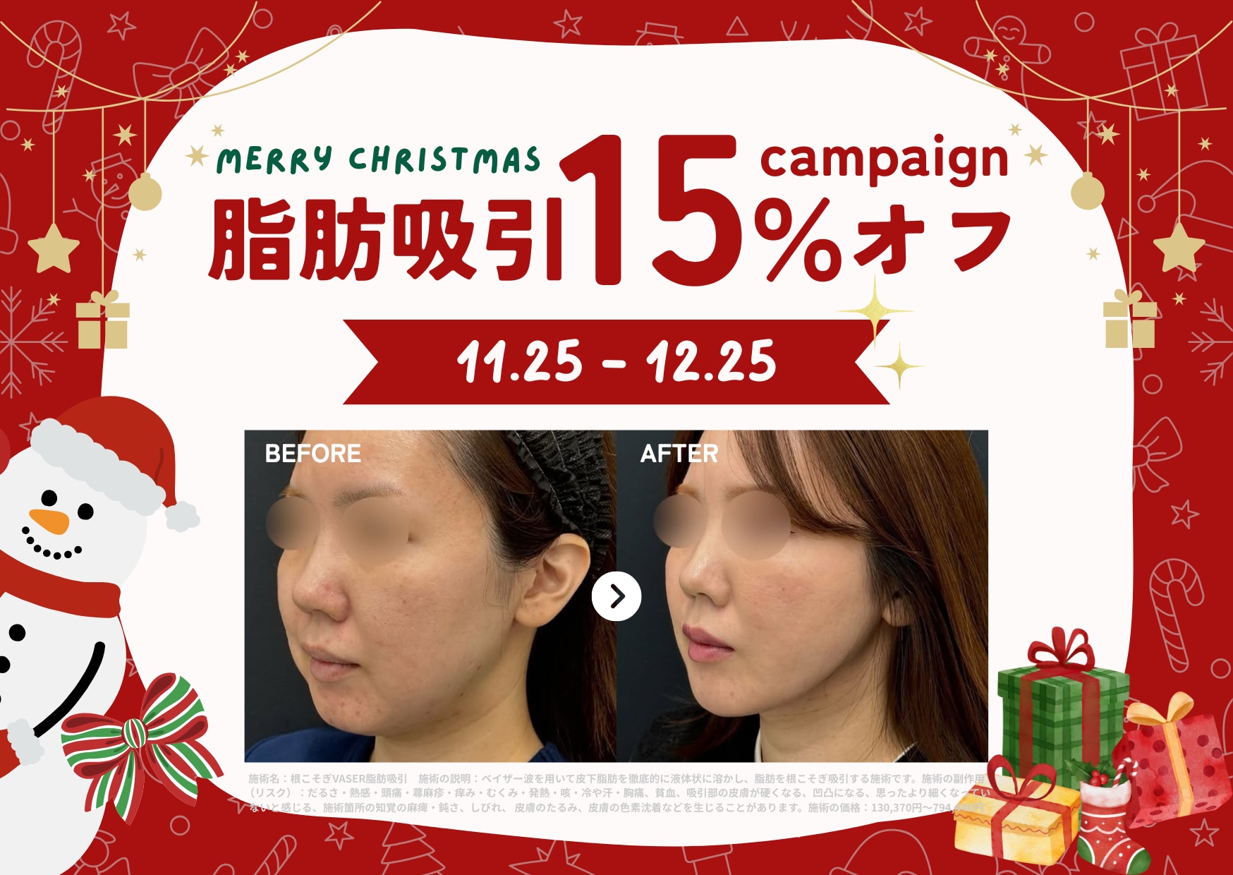 クリスマス特別キャンペーン🎄🕯️<br />
