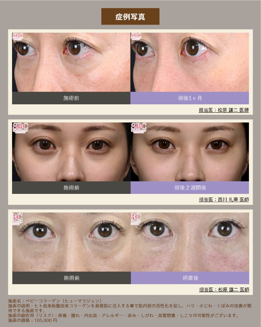 諦めていたシワにも！