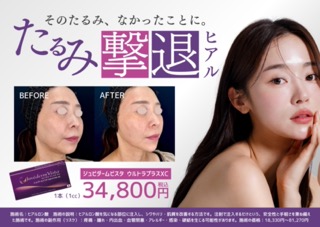 フェイスラインのゆるみや影にを✨