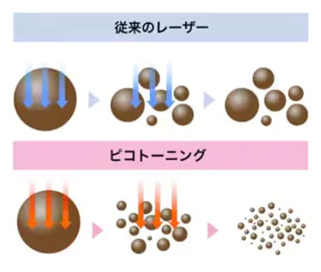 ピコ秒照射がもたらす、肌へのやさしさと高い効果