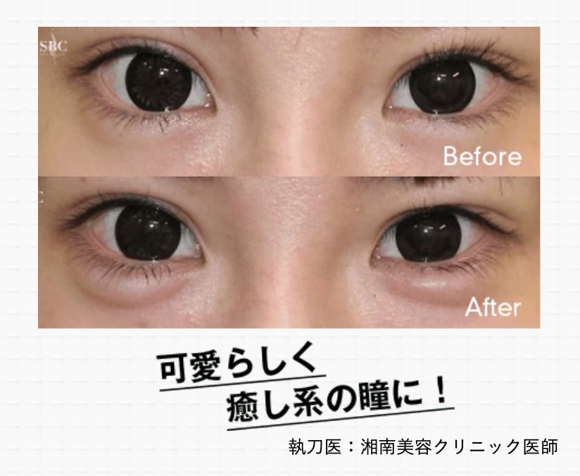 実際の Before→After をチェック✅