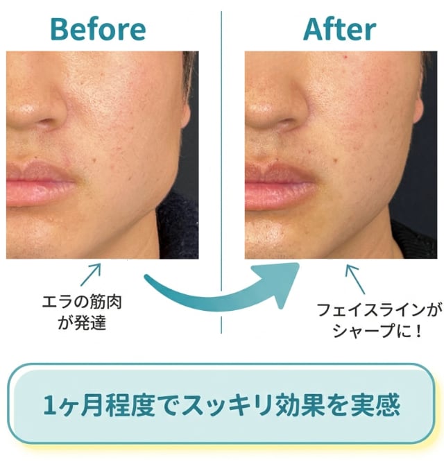 注射だけでこんなにスッキリ✨