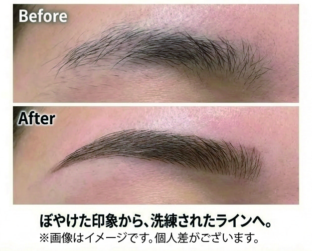 SBC新潟院の「医療ニードル脱毛」