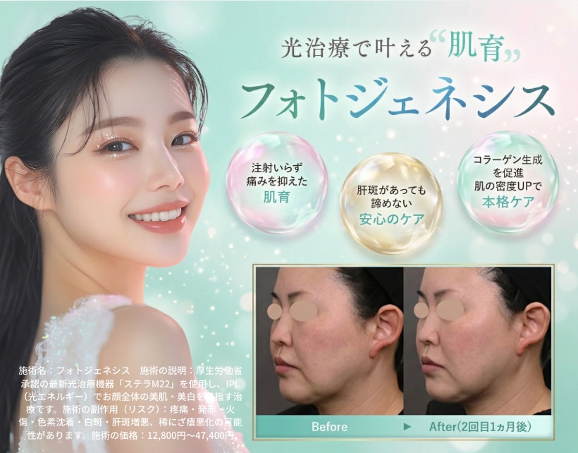 新潟院に新登場✨「フォトジェネシス」で叶える土台からの肌育ガイド🌿