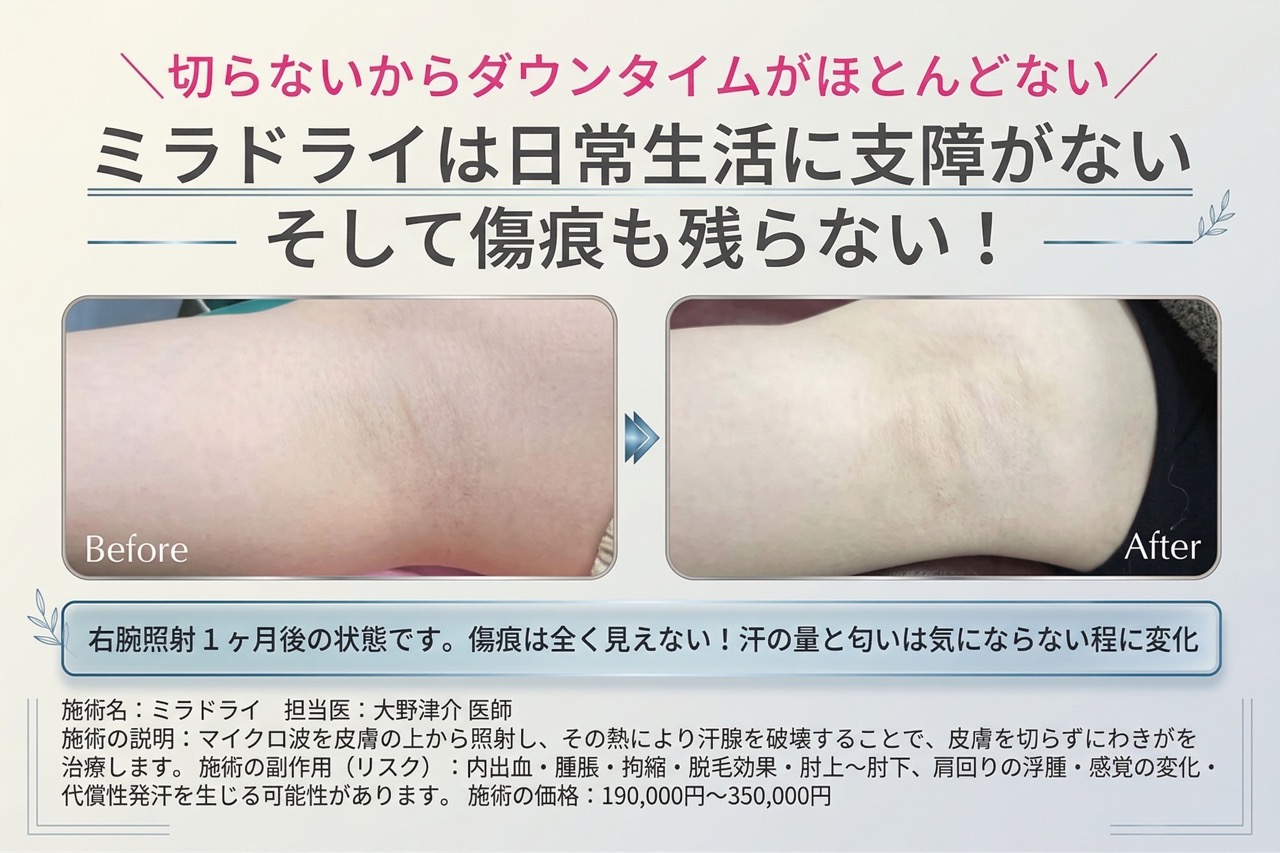 症例写真をみても傷痕が見当たらない！