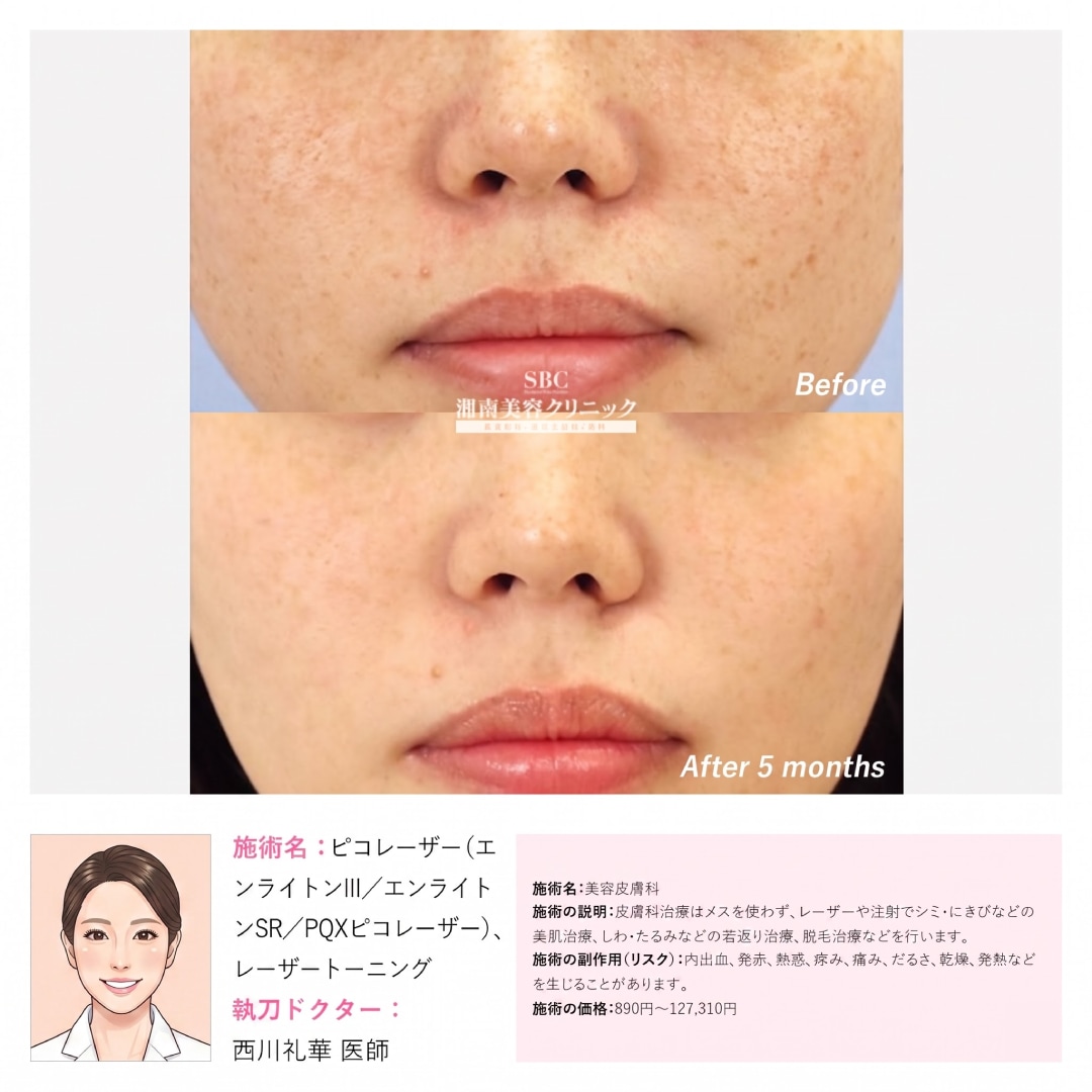 大きさ問わずまとめてしみケア！あなたは3個？10個？