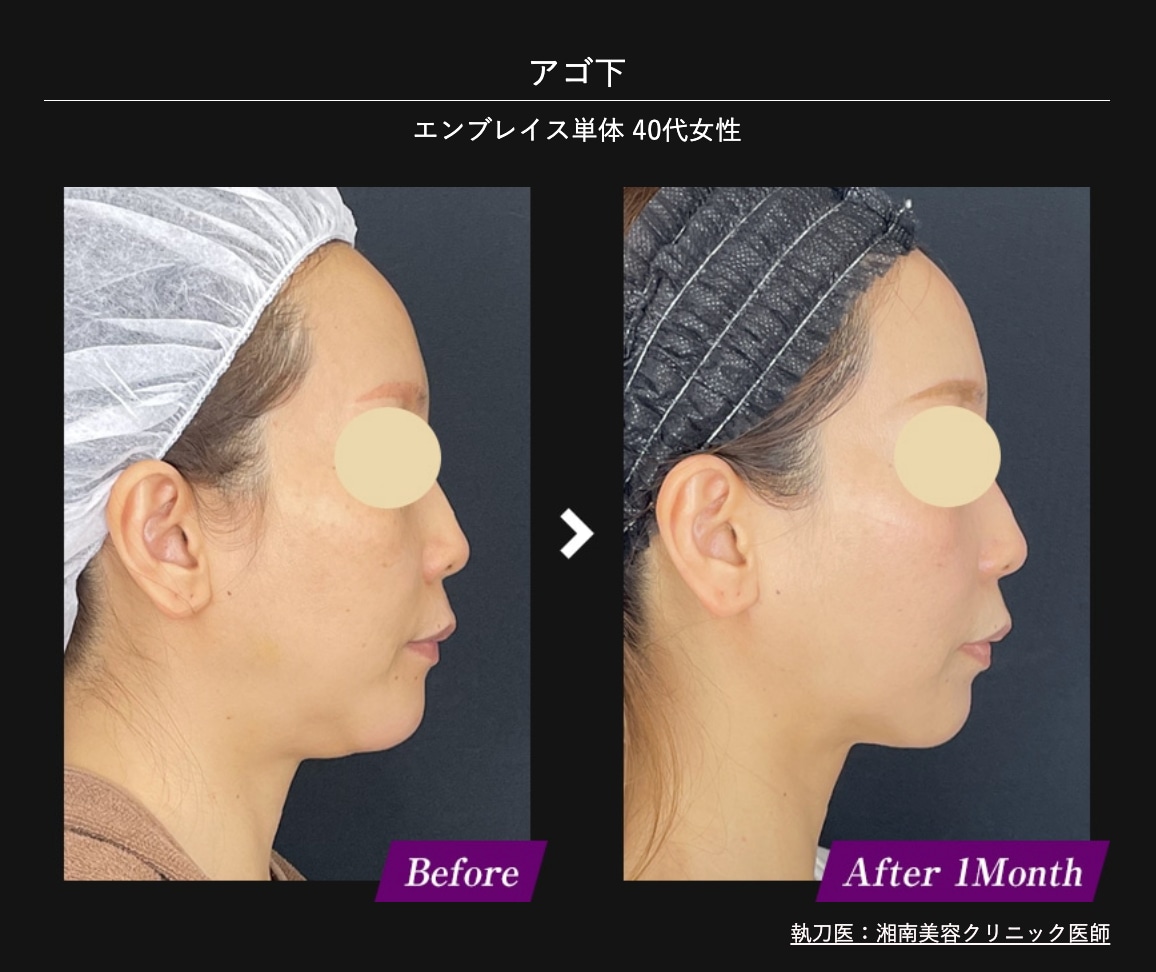 実際の変化をチェック