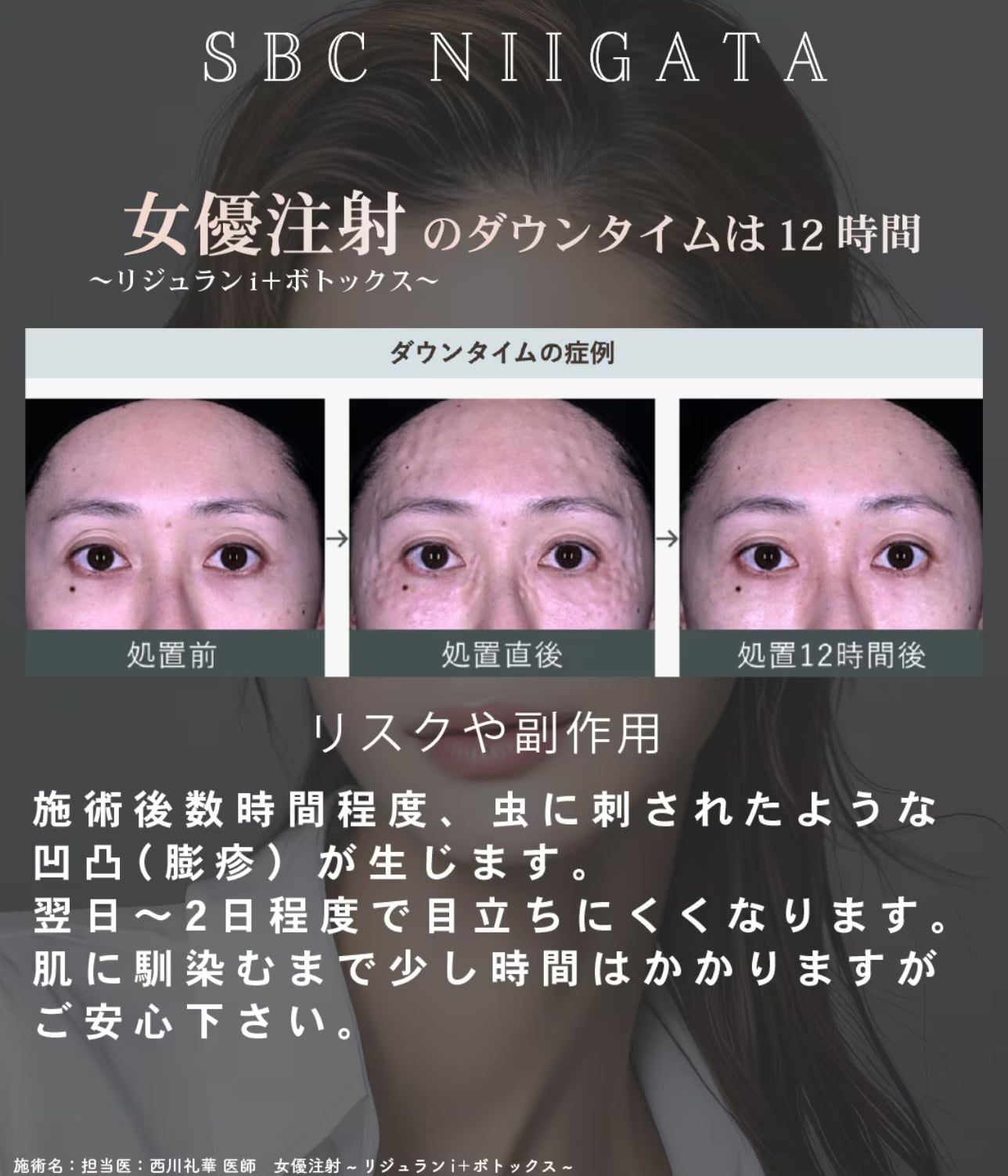 ダウンタイムの症例<br />
