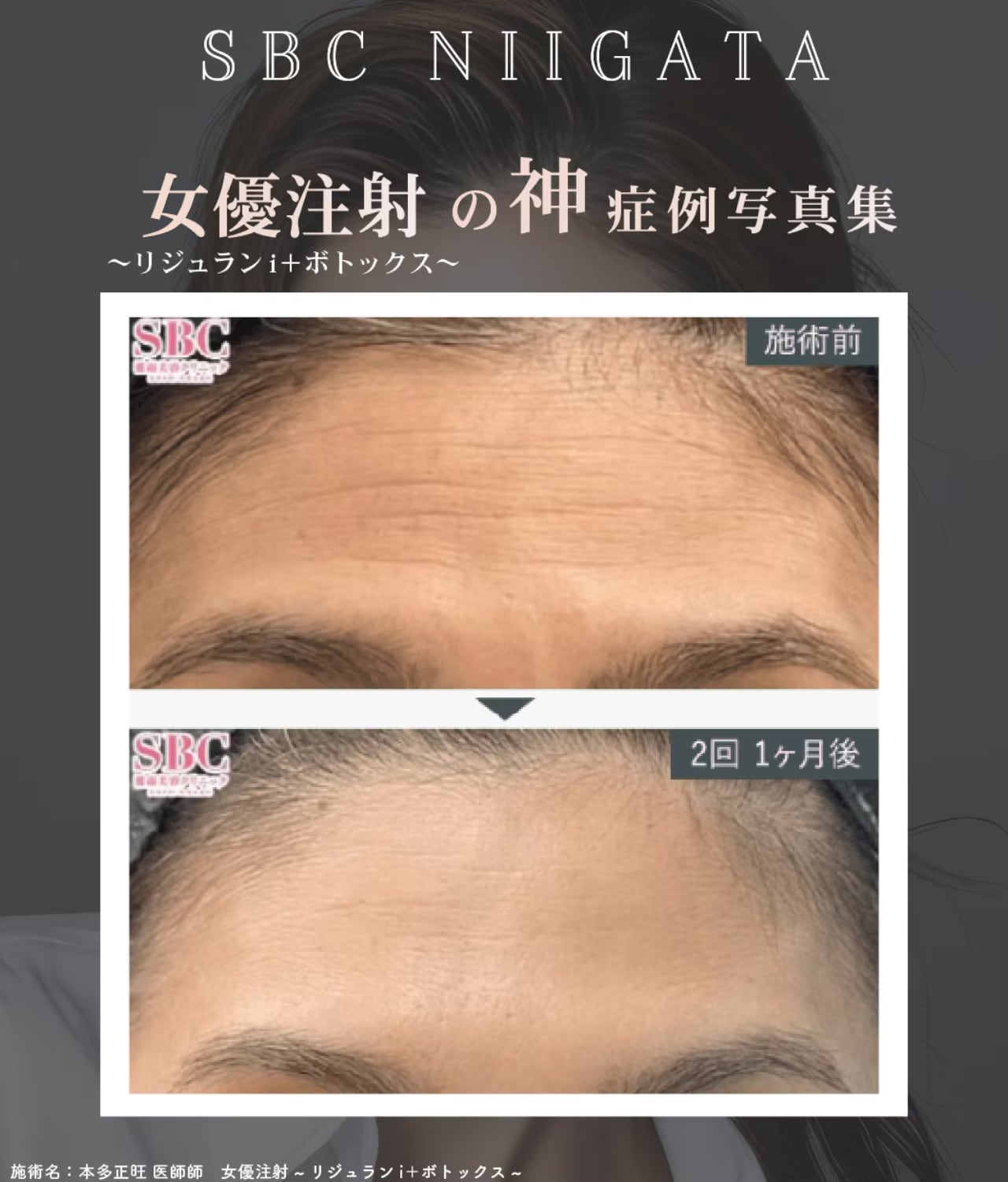 どんな角度からでも見ていたくなる肌へ！
