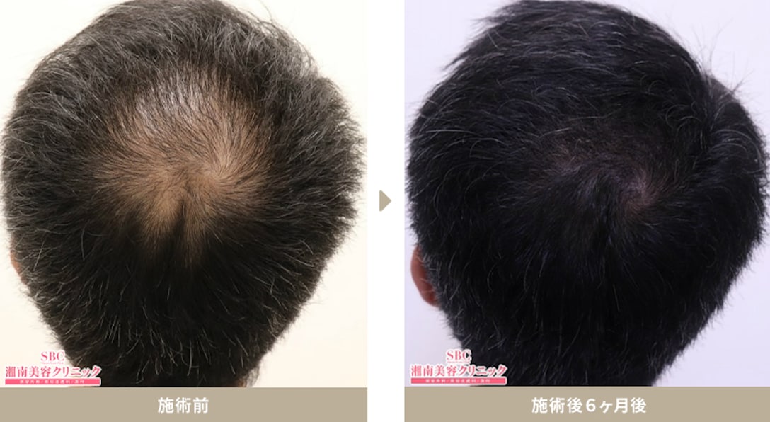 50代男性