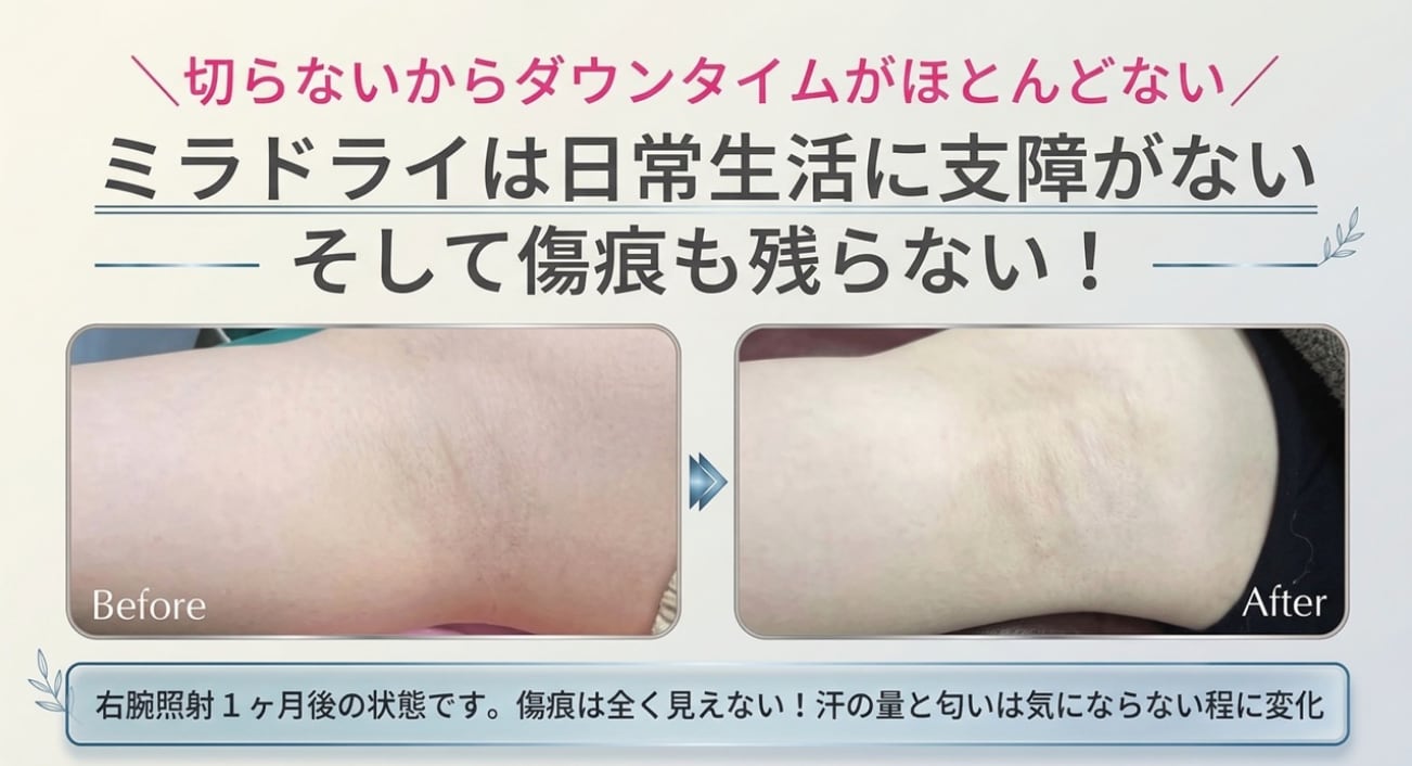 症例写真をみても傷痕が見当たらない！